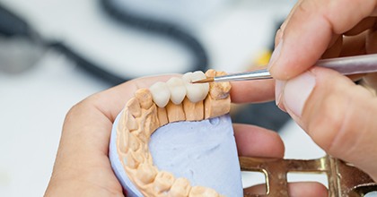 Lab technician creating a dental bridge